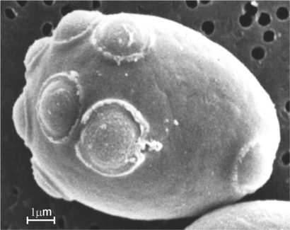 Figure 1: A Saccharomyces cell with multiple bud scars