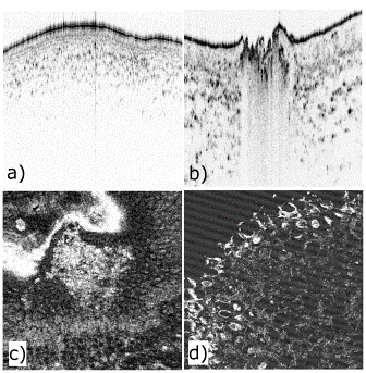 Figure 5 OCT cross sections of uncoated and coated extruded breakfast cereals from Nestlé, left hand side and right hand side, respectively. The images were acquired with the SD-OCT system. Copyright: RECENDT, Austria & Nestlé, Switzerland