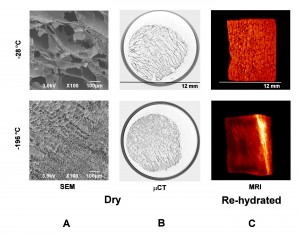 Figure 3 SEM, μCT and MRI images of cortical