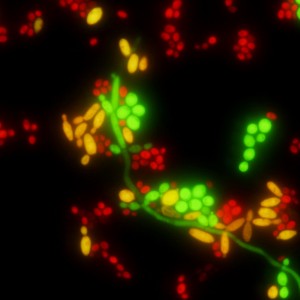 Figure 4 PNA FISH result for three Candida species using the Yeast Traffic Light™ kit from AdvanDx, Inc. (http://www.advandx.com). The kit uses a mixture of probes to provide colour-coded differentiation of yeast species within 90 minutes. In this mixed-species sample, C. albicans cells or pseudohyphae are green, C. tropicalis cells are yellow and C. glabrata cells are red. Copyright: M. Fiandaca, AdvanDx, Inc.