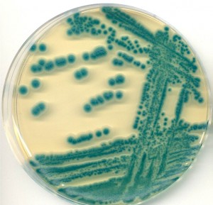 Oxoid Brilliance Bacillus cereus Agar