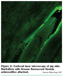 aabo figure 2