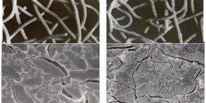 Figure 1 Cooked pasta: aspect (upper) and SEM images (bottom) of firm spaghetti (left) and sticky spaghetti (right)
