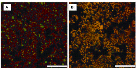 FIGURE 4 CLSM images of 1.5 per cent fat yoghurt made with (A) conventionally homogenised milk and (B) microfluidised milk (50MPa) showing interconnectedness of protein-fat network and the reduction in fat droplet size. Protein is labelled red and fat labelled green. Orange colour of B indicates co-localisation of fat and protein due to subresolution fat droplets. Scale bar = 25μm