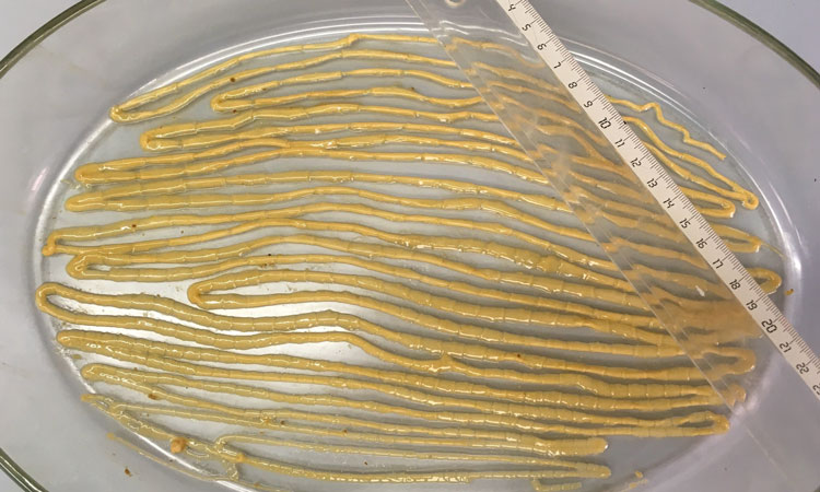 Single tapeworm (Taenia saginata) from a patient in Belgium in July 2018 (Photo credit, Idzi Potters, Institute of Tropical Medicine, Antwerp, Belgium