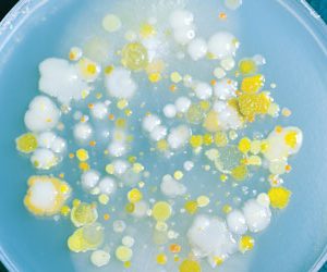 Fusarium mycotoxin contamination in the human food chain