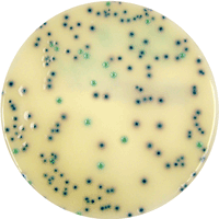 Brilliance™ ESBL Agar plate