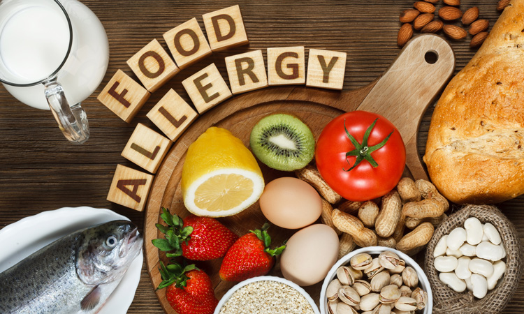 Food allergy update