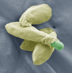 clostridium spore clostridium spore