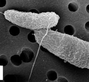 Scanning Electron Microscope (SEM) image of healthy, growing Vibrio parahaemolyticus.