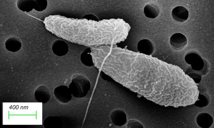 Scanning Electron Microscope (SEM) image of healthy, growing Vibrio parahaemolyticus.