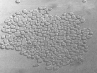 Figure 4: A typical Saccharomyces sp. yeast floc
