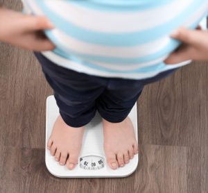 Government’s obesity strategy a “terrible missed opportunity,” says FDF