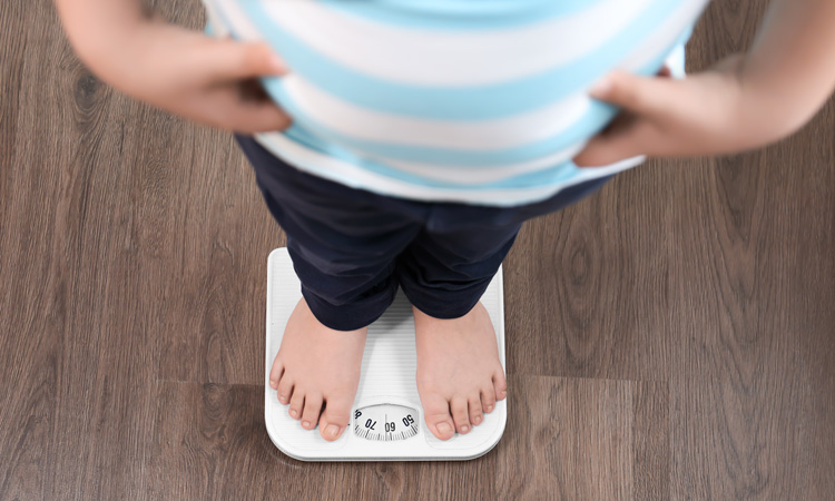 Government’s obesity strategy a “terrible missed opportunity,” says FDF