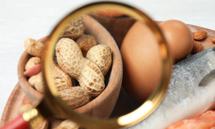 Peanut allergy study reveals psychosocial burden on allergic individuals