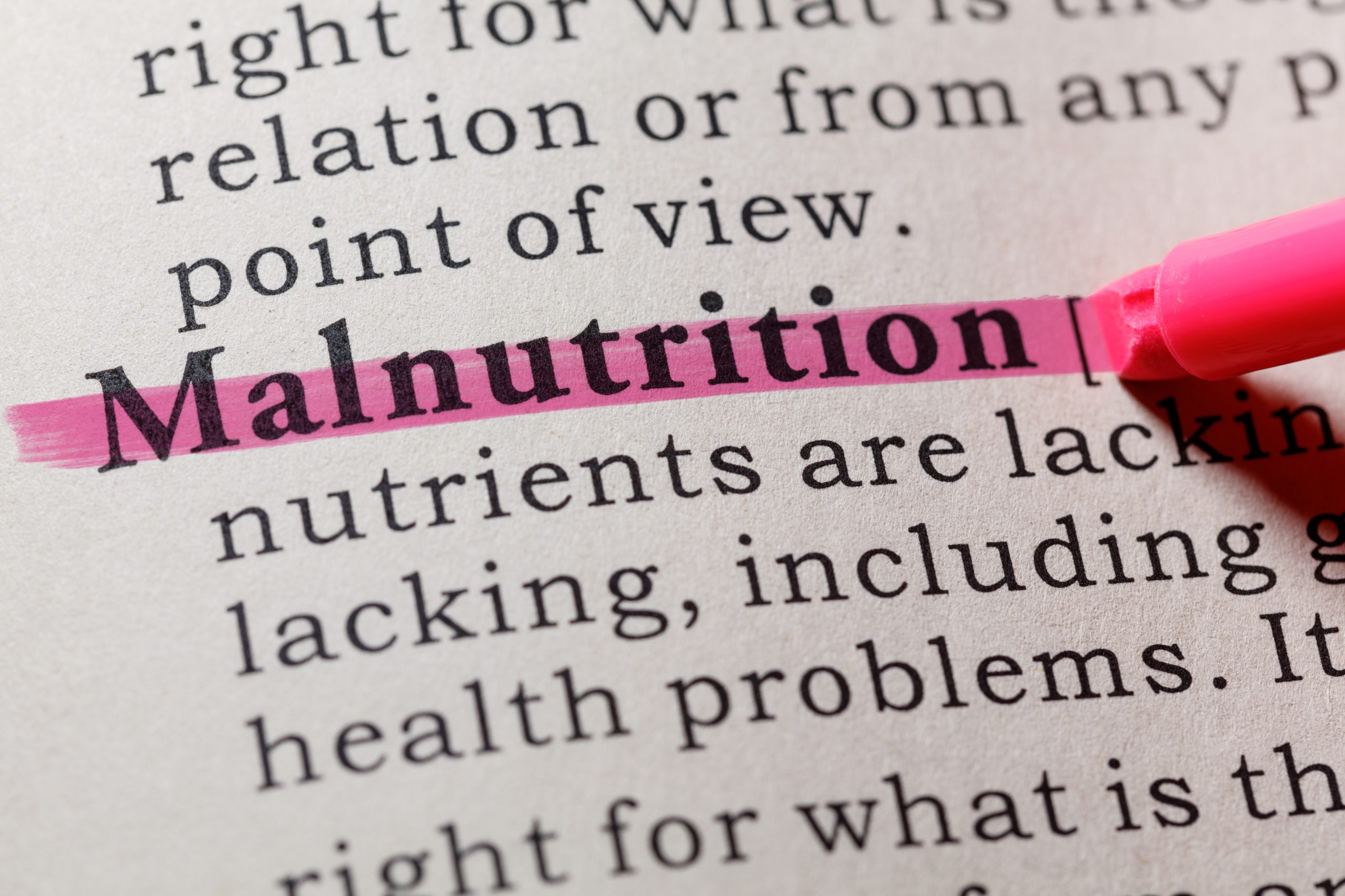 malnutrition