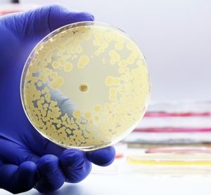 Foodborne antimicrobial resistance threat persists across Europe