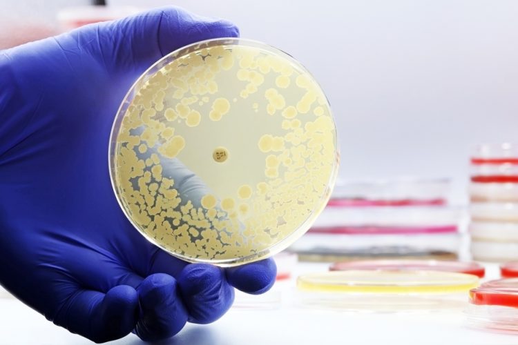 Foodborne antimicrobial resistance threat persists across Europe