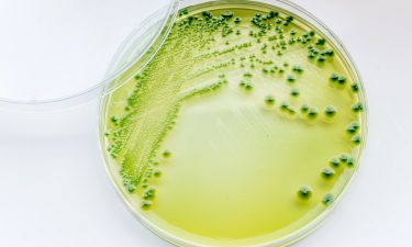 Vibrio parahaemolyticus is an organism which can cause illnesses such as nausea, vomiting, diarrhoea, fever and chills.